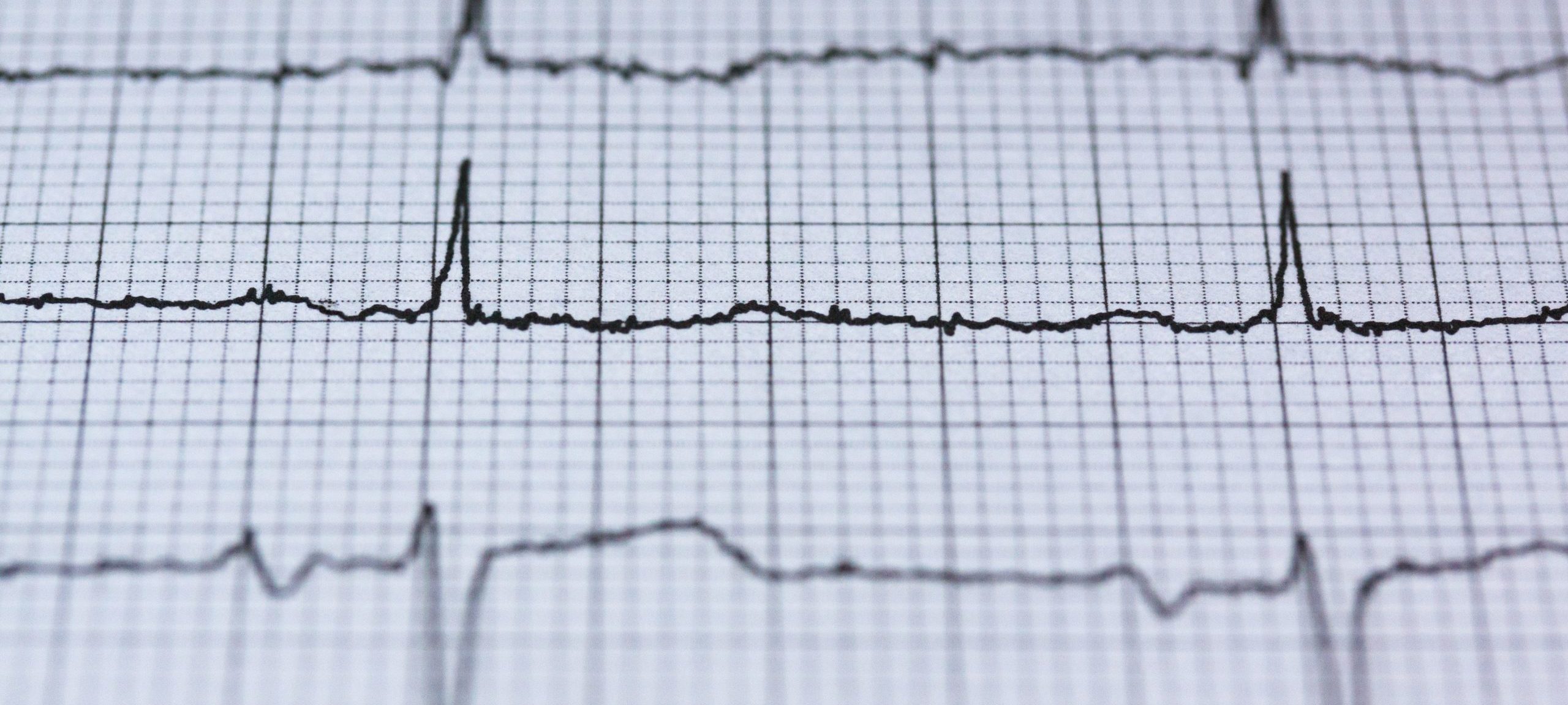 Close up view of an electrocardiograph